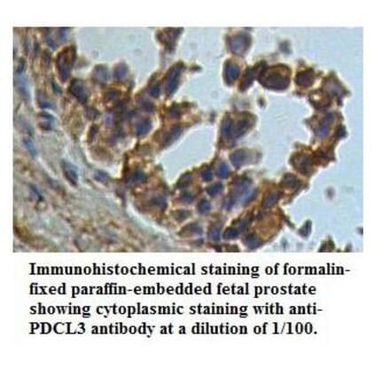 PDCL3 Antibody from Signalway Antibody (39533) - Antibodies.com