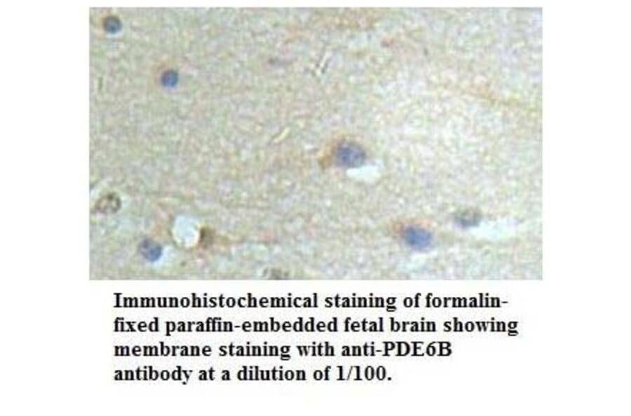 PDE6B Antibody from Signalway Antibody (39535) - Antibodies.com