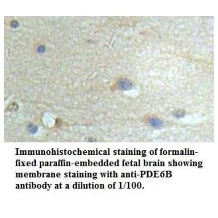 PDE6B Antibody from Signalway Antibody (39535) - Antibodies.com