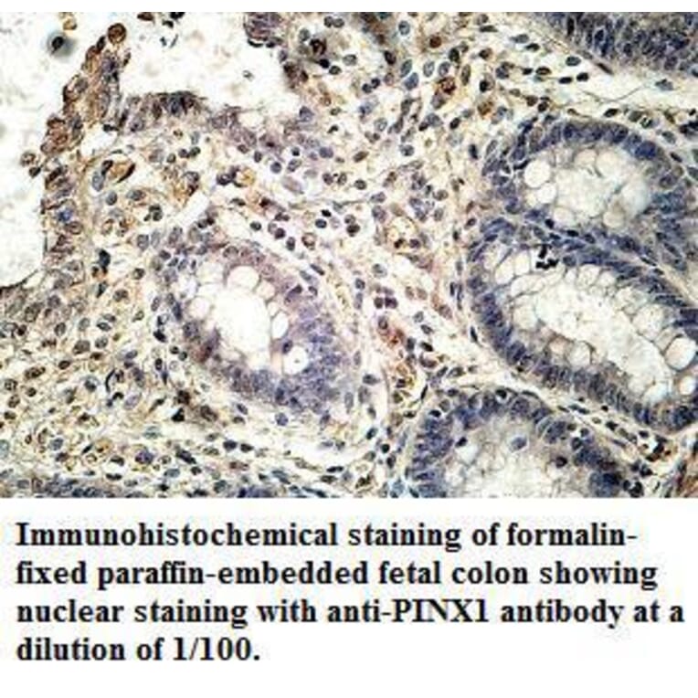 PINX1 Antibody from Signalway Antibody (39638) - Antibodies.com