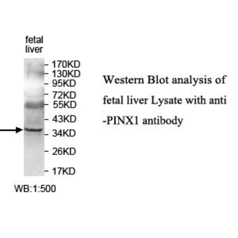 PINX1 Antibody from Signalway Antibody (39638) - Antibodies.com