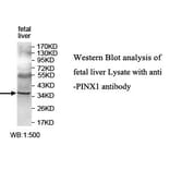 PINX1 Antibody from Signalway Antibody (39638) - Antibodies.com