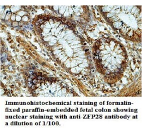 ZFP28 Antibody from Signalway Antibody (39694) - Antibodies.com