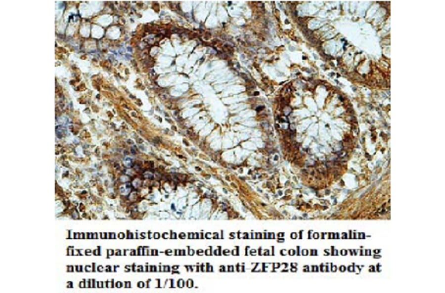 ZFP28 Antibody from Signalway Antibody (39694) - Antibodies.com
