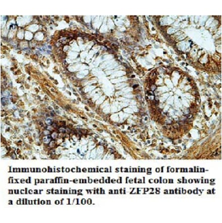 ZFP28 Antibody from Signalway Antibody (39694) - Antibodies.com