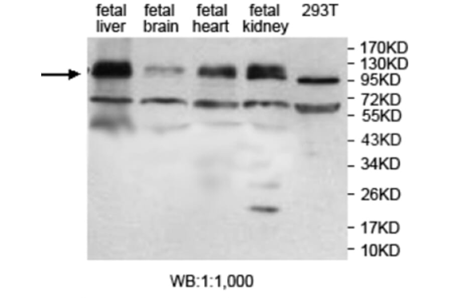 ZFP28 Antibody from Signalway Antibody (39694) - Antibodies.com