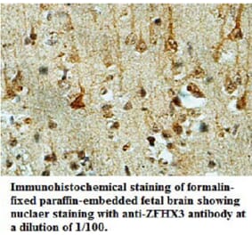 ZFHX3 Antibody from Signalway Antibody (39695) - Antibodies.com