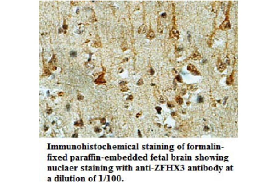 ZFHX3 Antibody from Signalway Antibody (39695) - Antibodies.com