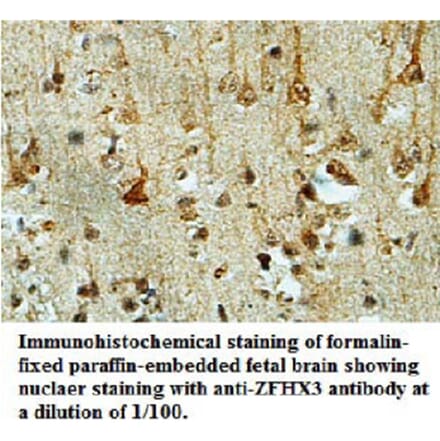 ZFHX3 Antibody from Signalway Antibody (39695) - Antibodies.com