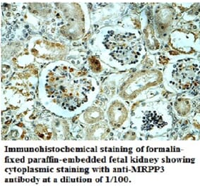 MRPP3 Antibody from Signalway Antibody (39698) - Antibodies.com