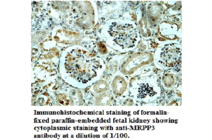 MRPP3 Antibody from Signalway Antibody (39698) - Antibodies.com