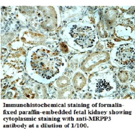 MRPP3 Antibody from Signalway Antibody (39698) - Antibodies.com