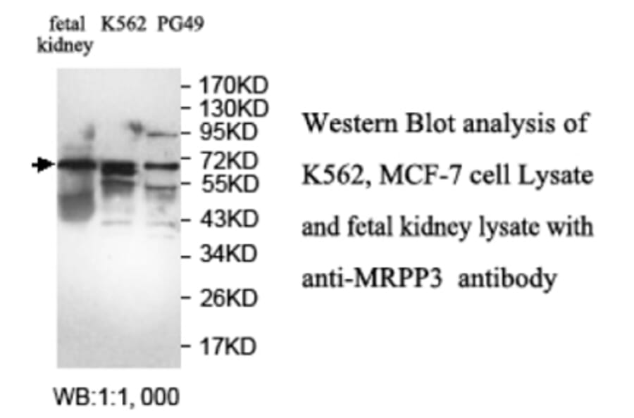 MRPP3 Antibody from Signalway Antibody (39698) - Antibodies.com