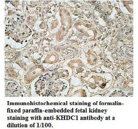 KHDC1 Antibody from Signalway Antibody (39701) - Antibodies.com