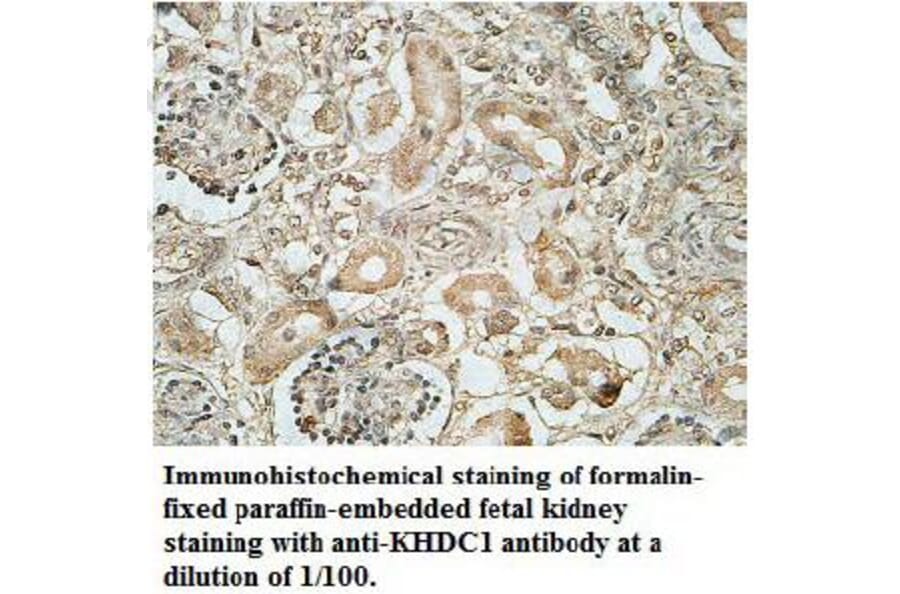 KHDC1 Antibody from Signalway Antibody (39701) - Antibodies.com