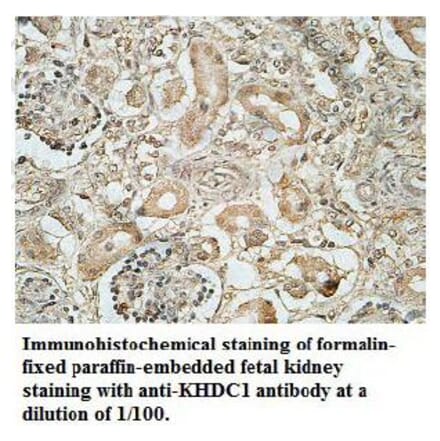 KHDC1 Antibody from Signalway Antibody (39701) - Antibodies.com