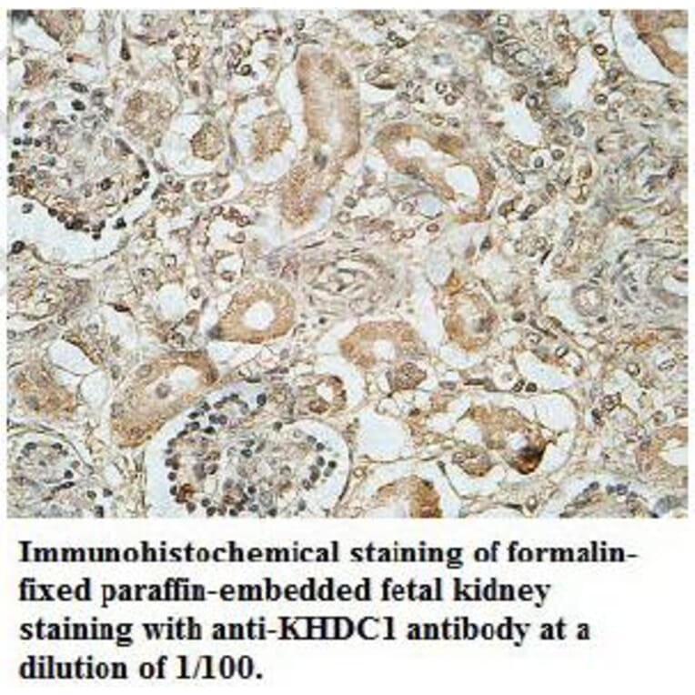 KHDC1 Antibody from Signalway Antibody (39701) - Antibodies.com