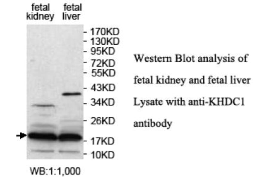 KHDC1 Antibody from Signalway Antibody (39701) - Antibodies.com