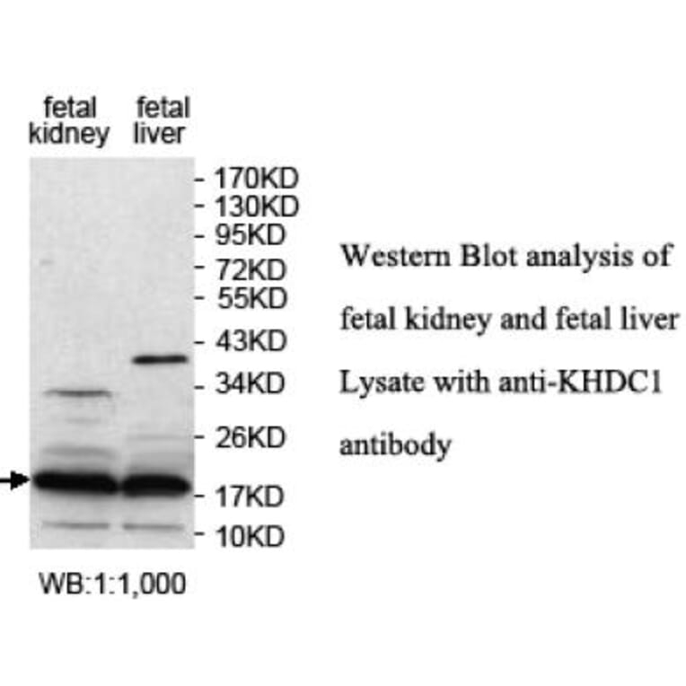 KHDC1 Antibody from Signalway Antibody (39701) - Antibodies.com