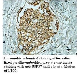 USP37 Antibody from Signalway Antibody (39705) - Antibodies.com