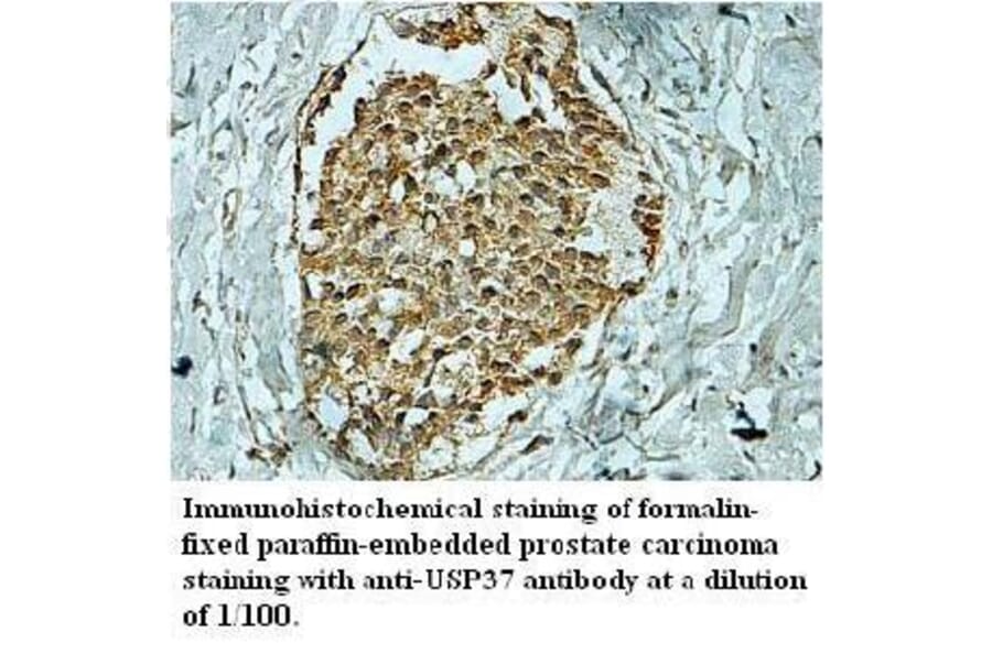 USP37 Antibody from Signalway Antibody (39705) - Antibodies.com