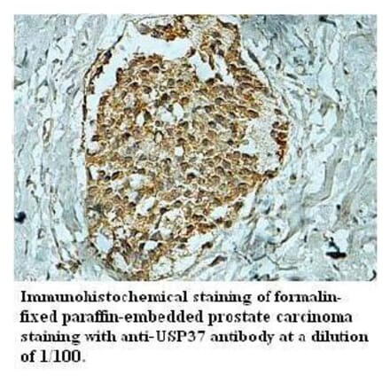 USP37 Antibody from Signalway Antibody (39705) - Antibodies.com