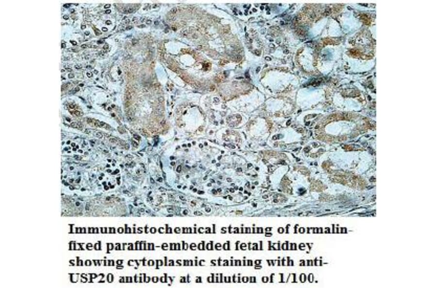 USP20 Antibody from Signalway Antibody (39706) - Antibodies.com