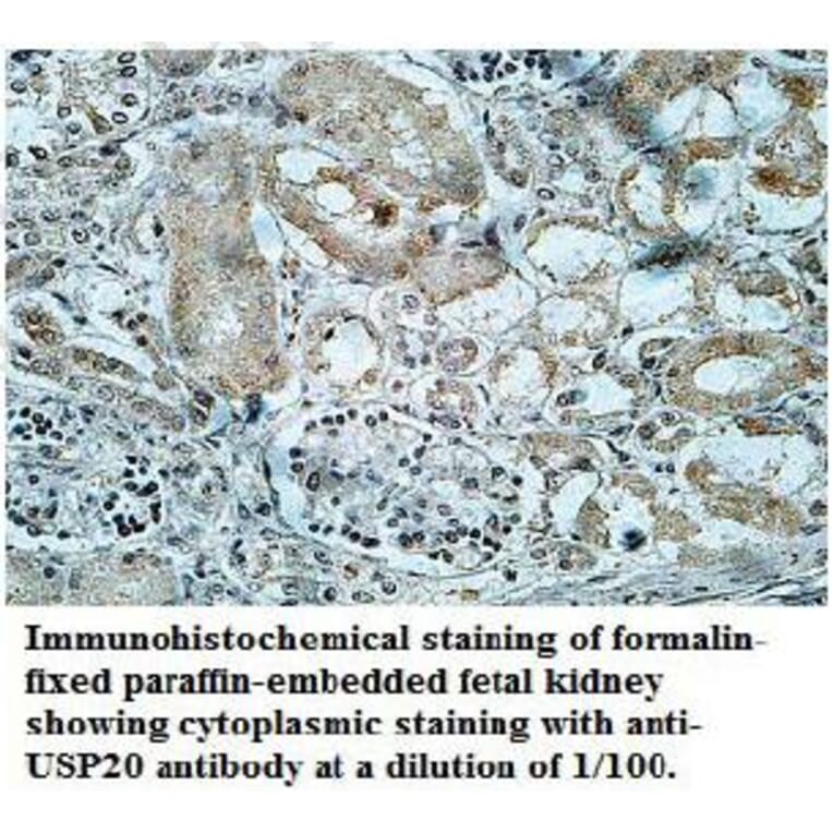 USP20 Antibody from Signalway Antibody (39706) - Antibodies.com