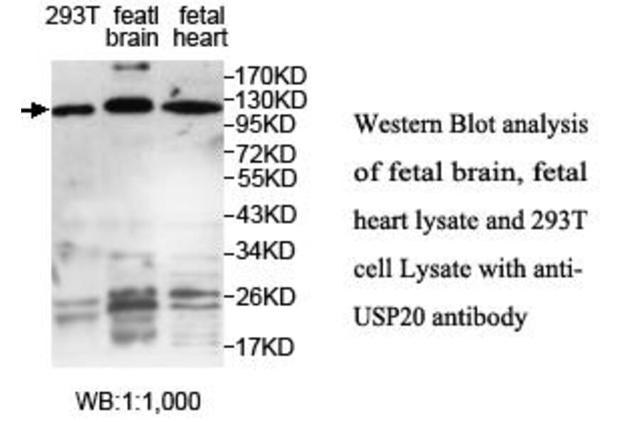 USP20 Antibody from Signalway Antibody (39706) - Antibodies.com