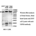 USP20 Antibody from Signalway Antibody (39706) - Antibodies.com