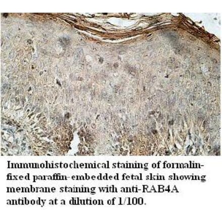 RAB4A Antibody from Signalway Antibody (39710) - Antibodies.com
