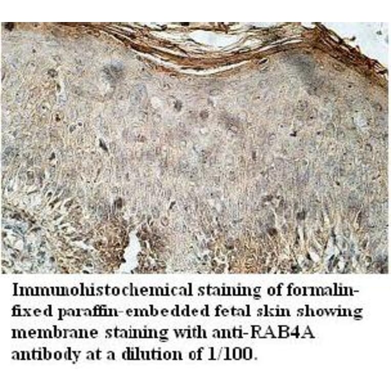 RAB4A Antibody from Signalway Antibody (39710) - Antibodies.com