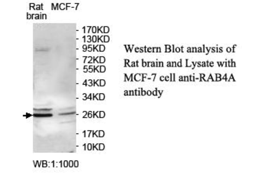 RAB4A Antibody from Signalway Antibody (39710) - Antibodies.com