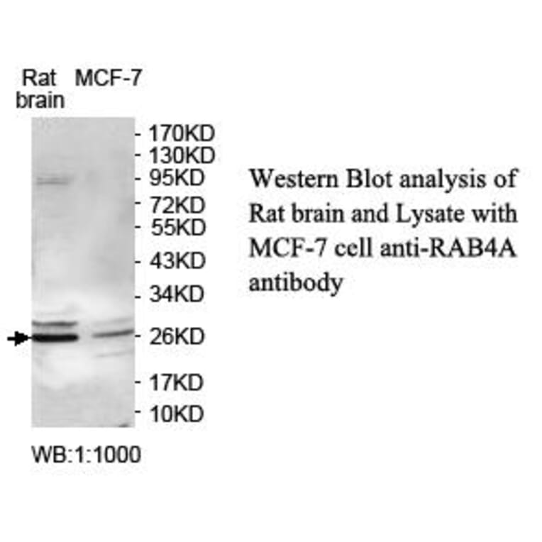RAB4A Antibody from Signalway Antibody (39710) - Antibodies.com