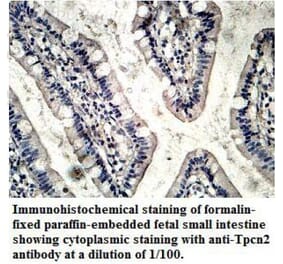 TPCN2 Antibody from Signalway Antibody (39714) - Antibodies.com