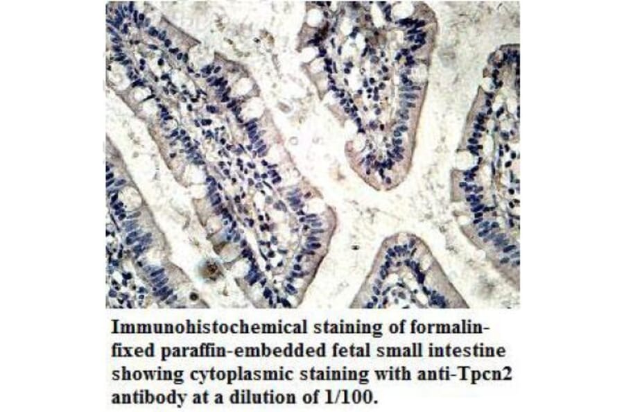 TPCN2 Antibody from Signalway Antibody (39714) - Antibodies.com