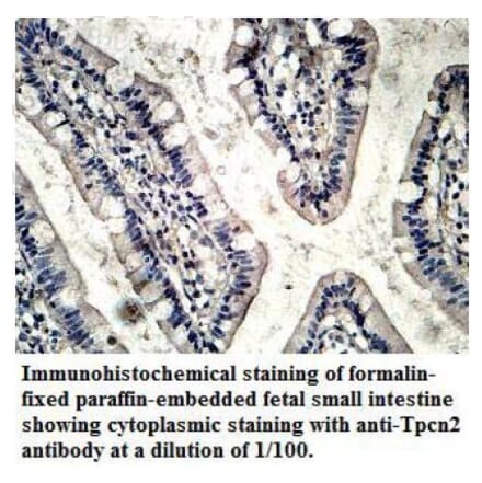 TPCN2 Antibody from Signalway Antibody (39714) - Antibodies.com