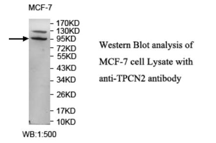 TPCN2 Antibody from Signalway Antibody (39714) - Antibodies.com
