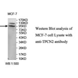 TPCN2 Antibody from Signalway Antibody (39714) - Antibodies.com