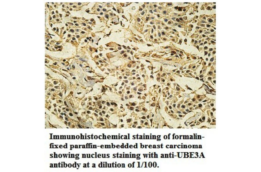 UBE3A Antibody from Signalway Antibody (39741) - Antibodies.com