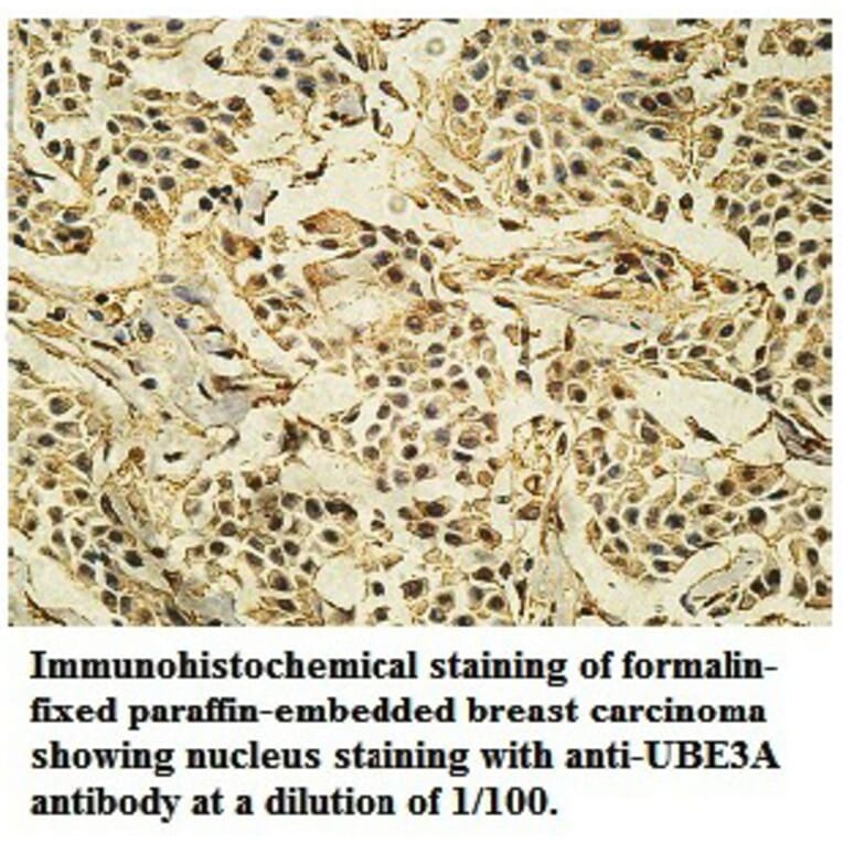UBE3A Antibody from Signalway Antibody (39741) - Antibodies.com