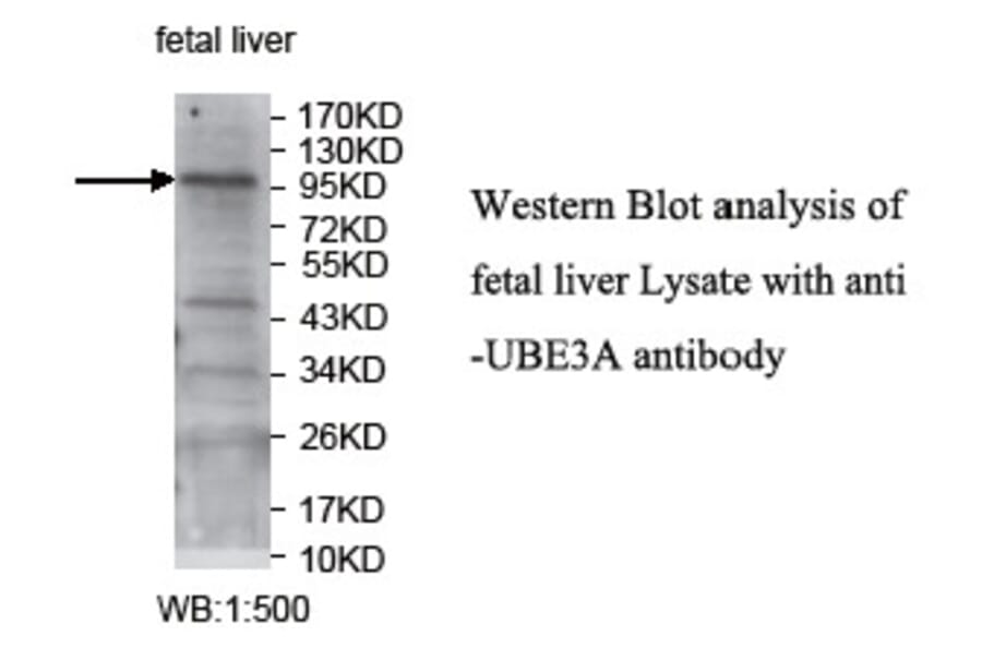 UBE3A Antibody from Signalway Antibody (39741) - Antibodies.com