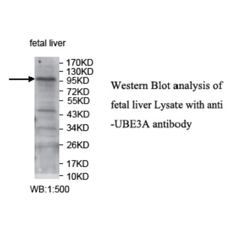 UBE3A Antibody from Signalway Antibody (39741) - Antibodies.com