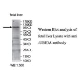 UBE3A Antibody from Signalway Antibody (39741) - Antibodies.com
