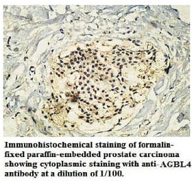 AGBL4 Antibody from Signalway Antibody (39747) - Antibodies.com