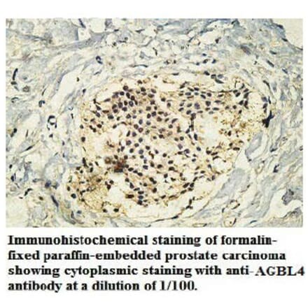 AGBL4 Antibody from Signalway Antibody (39747) - Antibodies.com