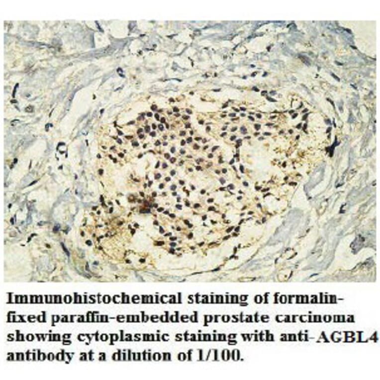 AGBL4 Antibody from Signalway Antibody (39747) - Antibodies.com