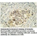 AGBL4 Antibody from Signalway Antibody (39747) - Antibodies.com