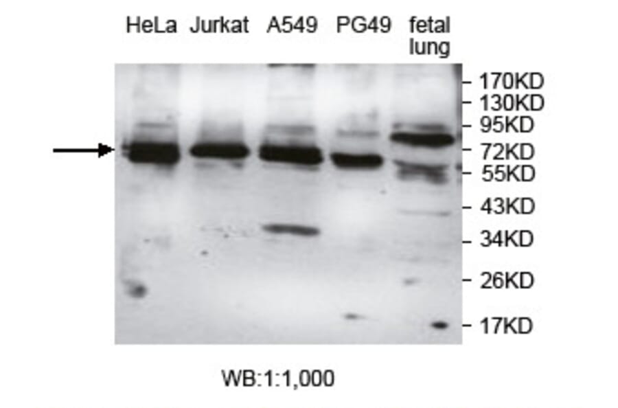 AGBL4 Antibody from Signalway Antibody (39747) - Antibodies.com