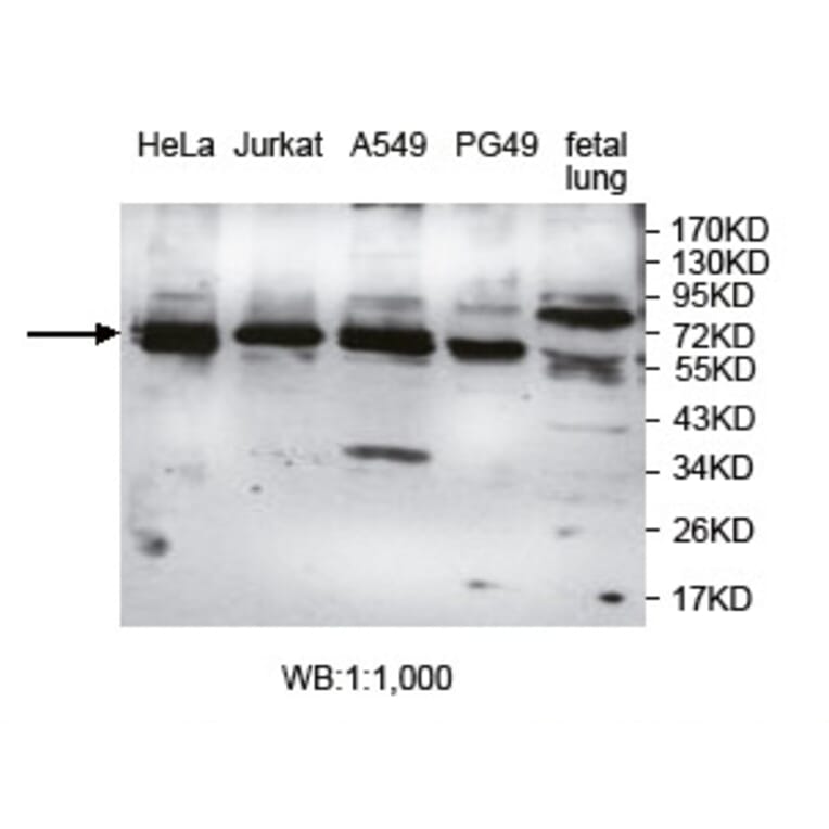AGBL4 Antibody from Signalway Antibody (39747) - Antibodies.com